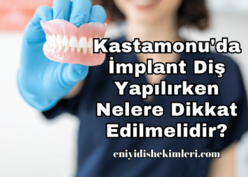 Kastamonu'da İmplant Diş Yapılırken Nelere Dikkat Edilmelidir?