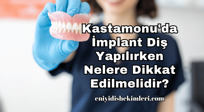 Kastamonu'da İmplant Diş Yapılırken Nelere Dikkat Edilmelidir?