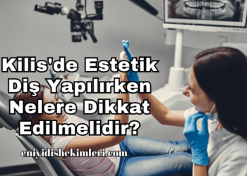 Kilis'de Estetik Diş Yapılırken Nelere Dikkat Edilmelidir?