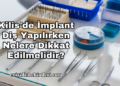 Kilis'de İmplant Diş Yapılırken Nelere Dikkat Edilmelidir?
