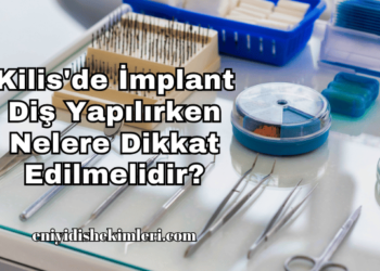 Kilis'de İmplant Diş Yapılırken Nelere Dikkat Edilmelidir?