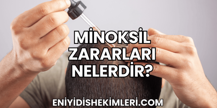 Minoksil Zararları Nelerdir?