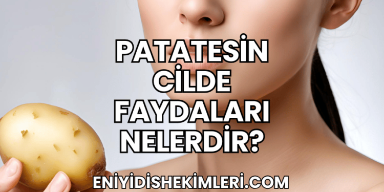 Patatesin Cilde Faydaları Nelerdir?