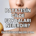 Patatesin Cilde Faydaları Nelerdir?