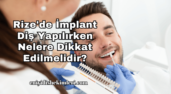 Rize’de İmplant Diş Yapılırken Nelere Dikkat Edilmelidir?