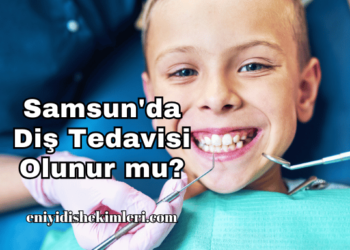 Samsun'da Diş Tedavisi Olunur mu?