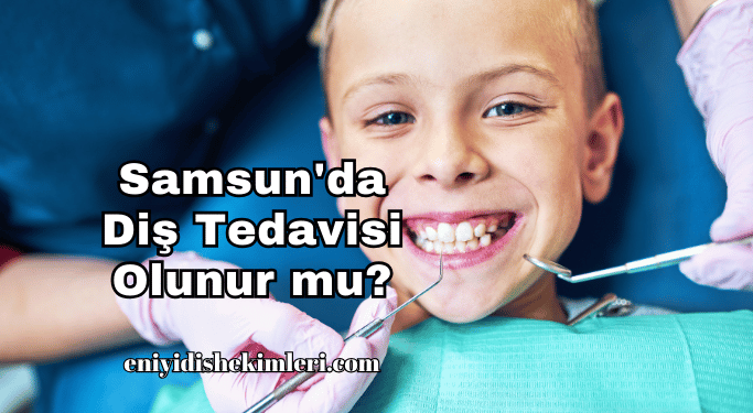 Samsun'da Diş Tedavisi Olunur mu?