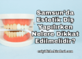 Samsun'da Estetik Diş Yapılırken Nelere Dikkat Edilmelidir?