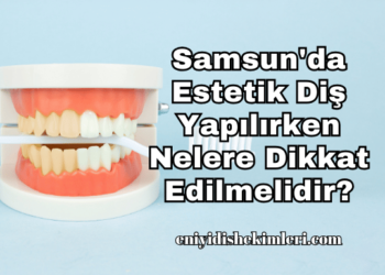 Samsun'da Estetik Diş Yapılırken Nelere Dikkat Edilmelidir?