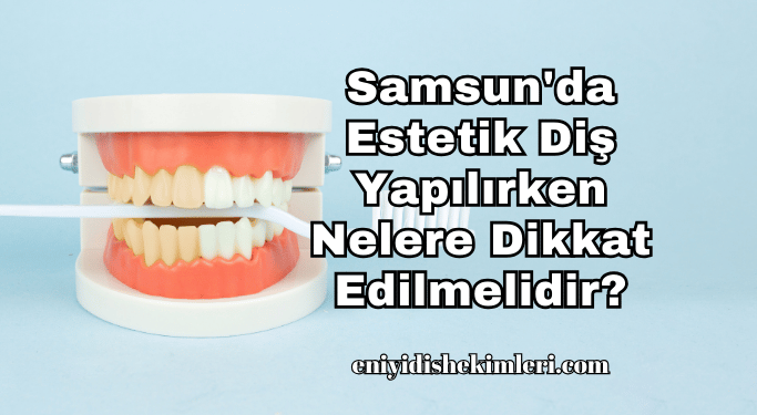 Samsun'da Estetik Diş Yapılırken Nelere Dikkat Edilmelidir?