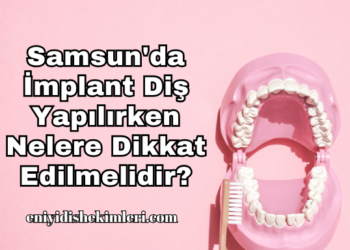 Samsun'da İmplant Diş Yapılırken Nelere Dikkat Edilmelidir?