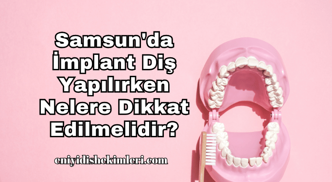 Samsun'da İmplant Diş Yapılırken Nelere Dikkat Edilmelidir?
