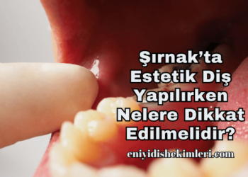Şırnak’ta Estetik Diş Yapılırken Nelere Dikkat Edilmelidir?