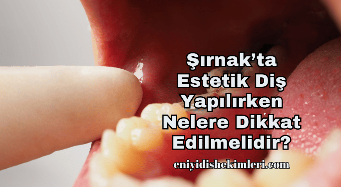 Şırnak’ta Estetik Diş Yapılırken Nelere Dikkat Edilmelidir?