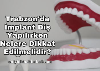Trabzon'da İmplant Diş Yapılırken Nelere Dikkat Edilmelidir?
