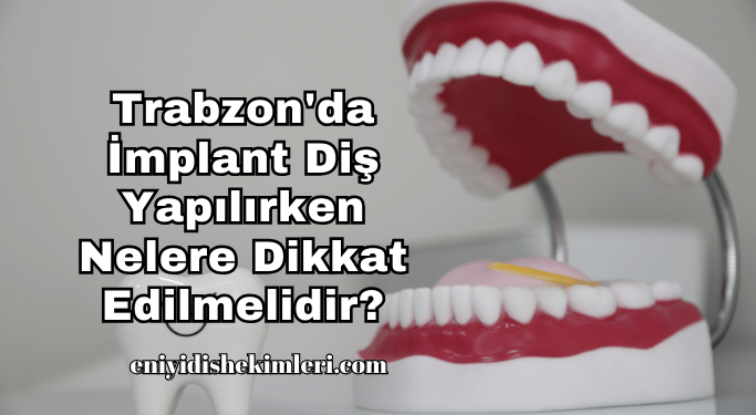 Trabzon'da İmplant Diş Yapılırken Nelere Dikkat Edilmelidir?