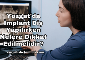 Yozgat'da İmplant Diş Yapılırken Nelere Dikkat Edilmelidir?