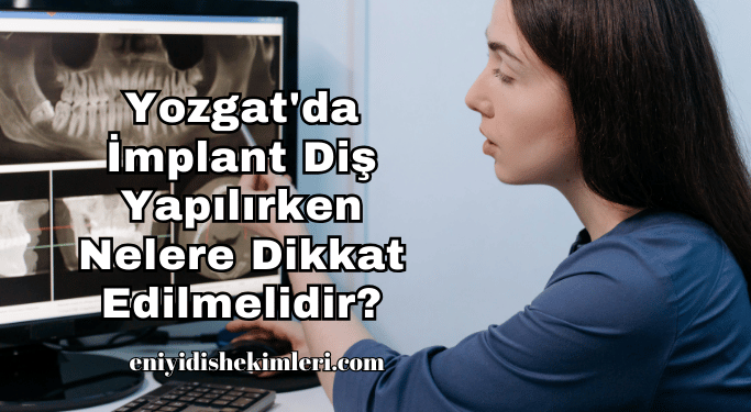 Yozgat'da İmplant Diş Yapılırken Nelere Dikkat Edilmelidir?