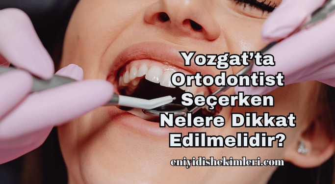 Yozgat’ta Ortodontist Seçerken Nelere Dikkat Edilmelidir?