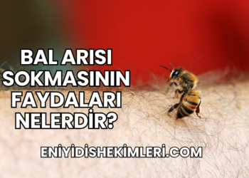 Bal Arısı Sokmasının Faydaları Nelerdir?
