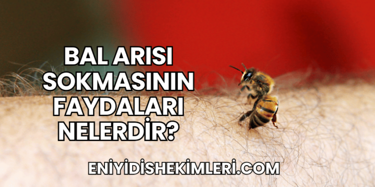 Bal Arısı Sokmasının Faydaları Nelerdir?