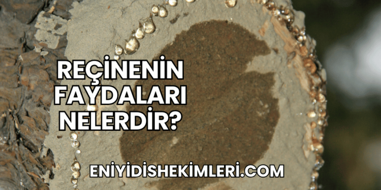 Reçinenin Faydaları Nelerdir?