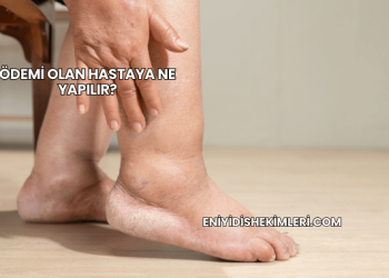 Ödemi Olan Hastaya Ne Yapılır?