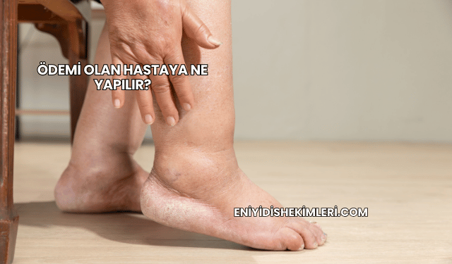 Ödemi Olan Hastaya Ne Yapılır?