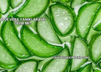 Aloe Vera Yanıklara İyi Gelir mi?
