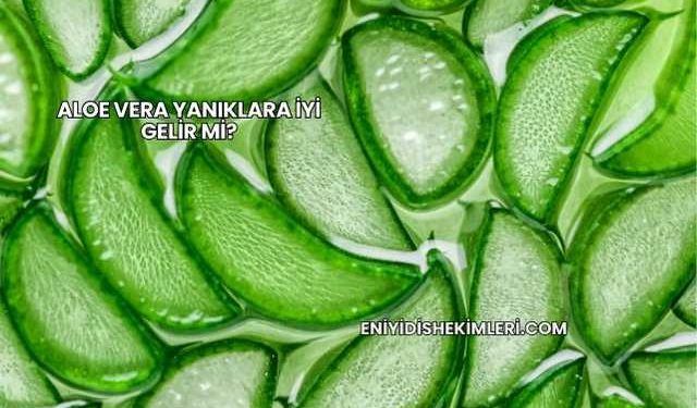 Aloe Vera Yanıklara İyi Gelir mi?