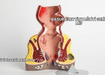 Basura Zeytinyağı İyi Gelir mi?