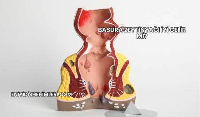 Basura Zeytinyağı İyi Gelir mi?