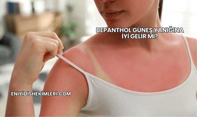 Bepanthol Güneş Yanığına İyi Gelir mi?