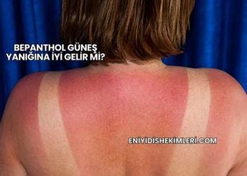 Bepanthol Güneş Yanığına İyi Gelir mi?
