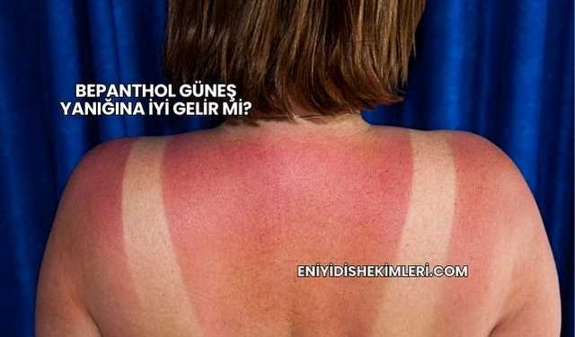 Bepanthol Güneş Yanığına İyi Gelir mi?