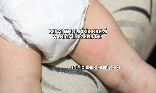 Bepanthol Pişik Kremi Yanığa İyi Gelir mi?