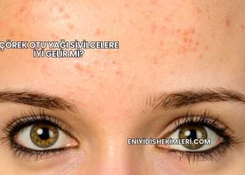 Çörek Otu Yağı Sivilcelere İyi Gelir mi?