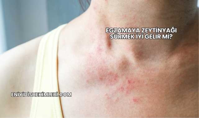 Egzamaya Zeytinyağı Sürmek İyi Gelir mi?
