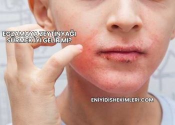 Egzamaya Zeytinyağı Sürmek İyi Gelir mi?