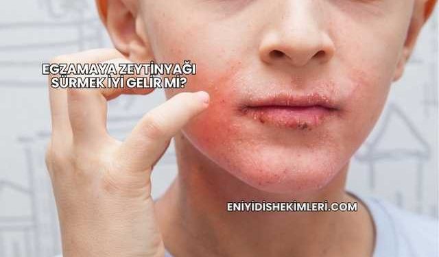 Egzamaya Zeytinyağı Sürmek İyi Gelir mi?