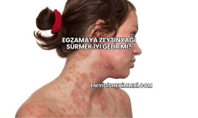 Egzamaya Zeytinyağı Sürmek İyi Gelir mi?