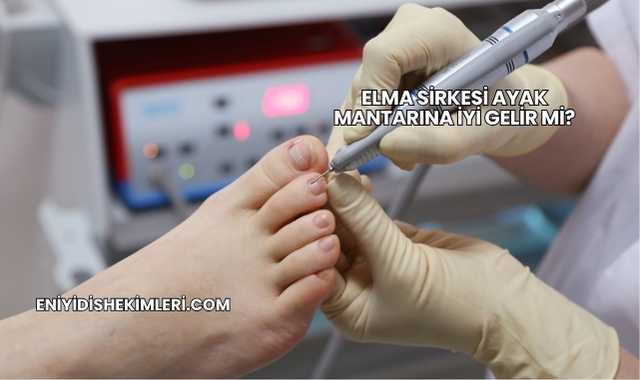 Elma Sirkesi Ayak Mantarına İyi Gelir mi?