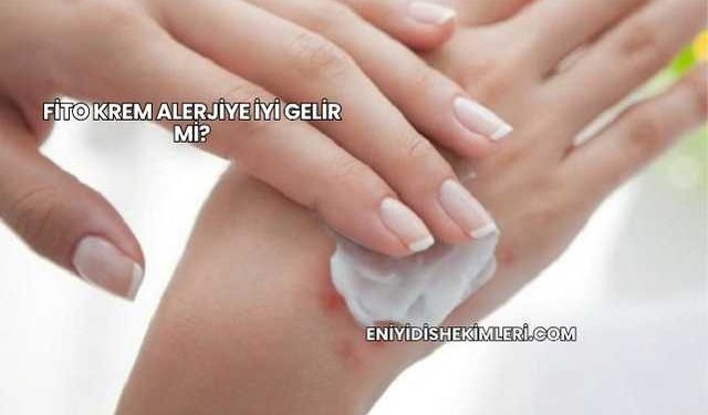 Fito Krem Alerjiye İyi Gelir mi?