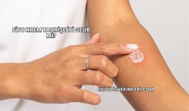 Fito Krem Tahrişe İyi Gelir mi?