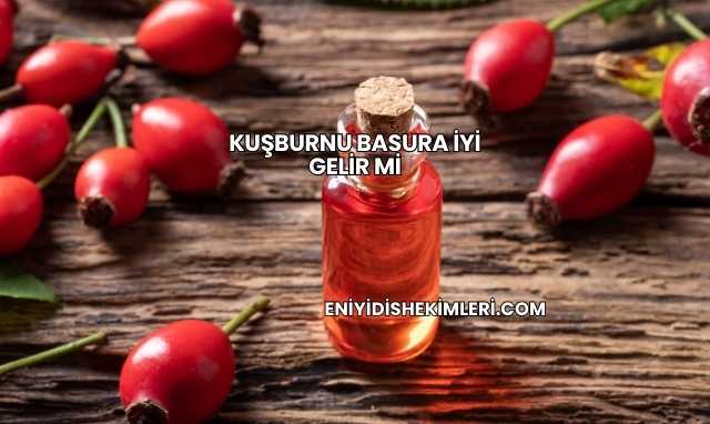 Kuşburnu Basura İyi Gelir mi
