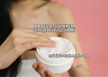 Madecassol Krem Lekelere İyi Gelir mi?