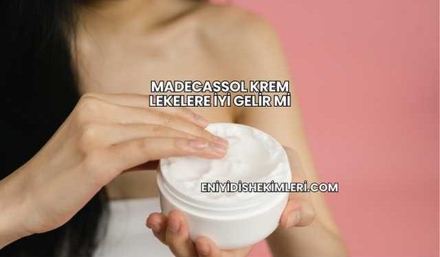 Madecassol Krem Lekelere İyi Gelir mi?