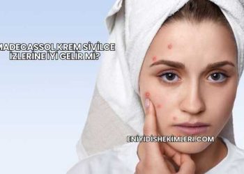 Madecassol Krem Sivilce İzlerine İyi Gelir mi?