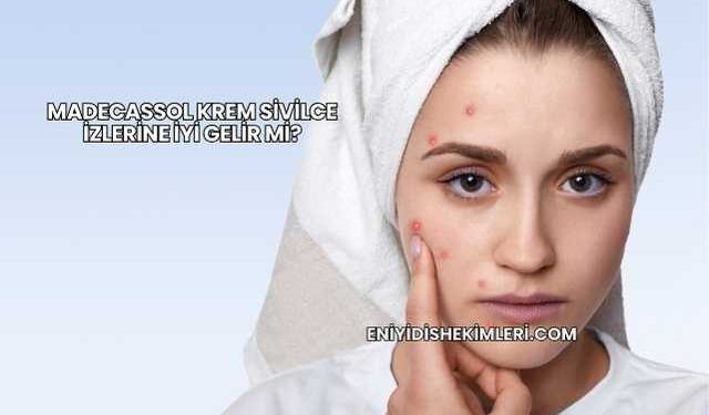 Madecassol Krem Sivilce İzlerine İyi Gelir mi?