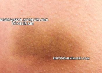 Madecassol Morluklara İyi Gelir mi?